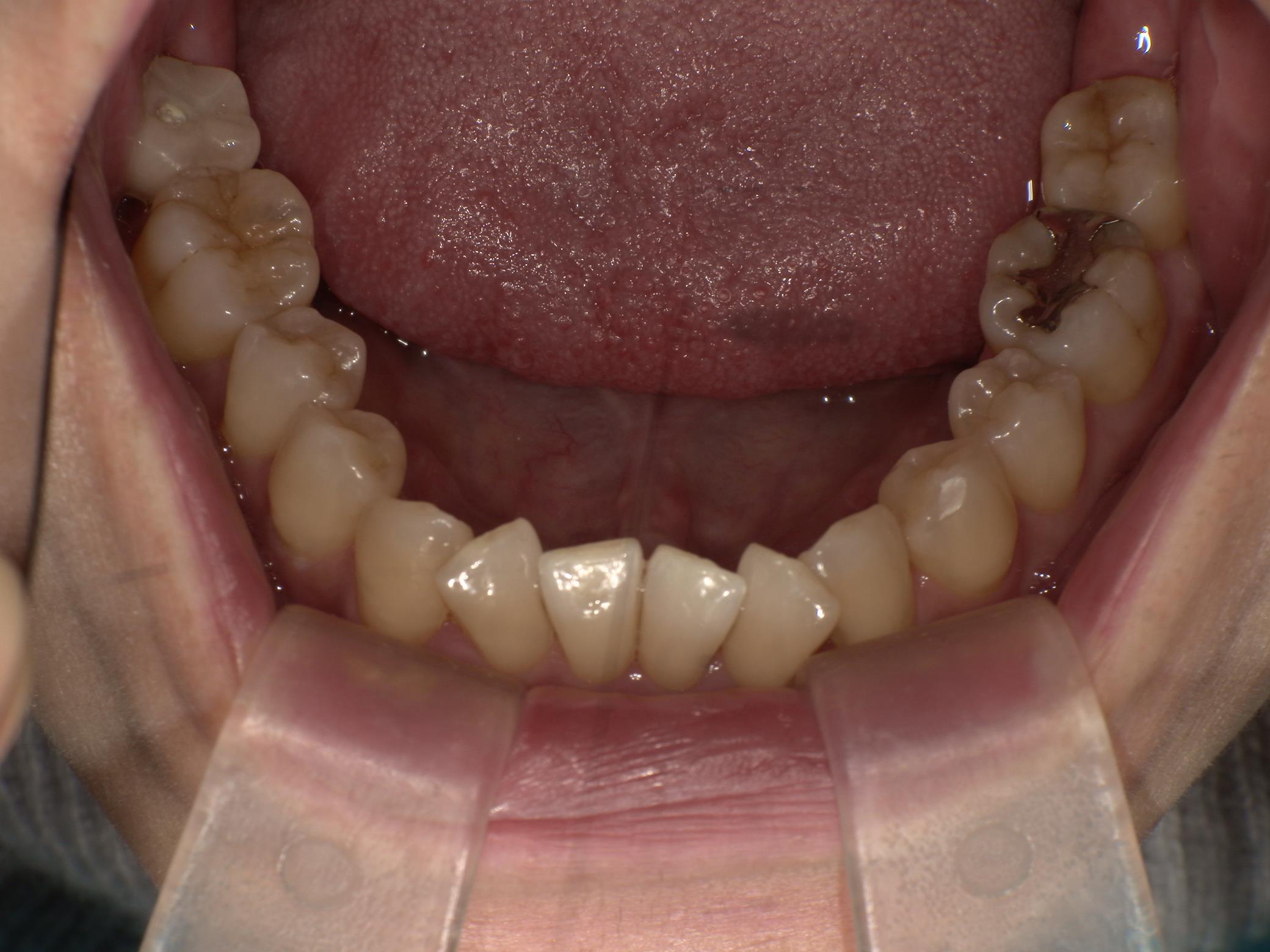 After